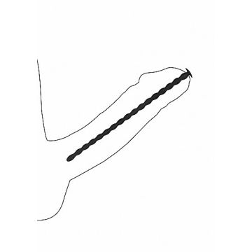 Siliconen Dilator Set - Spiraalvorm