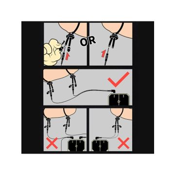 Dungeon Lab 6 mm Conductive Rubberen Ringen PRO